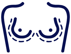 mamoplastia-clinica-de-estetica-dr-rodrigo-honorato